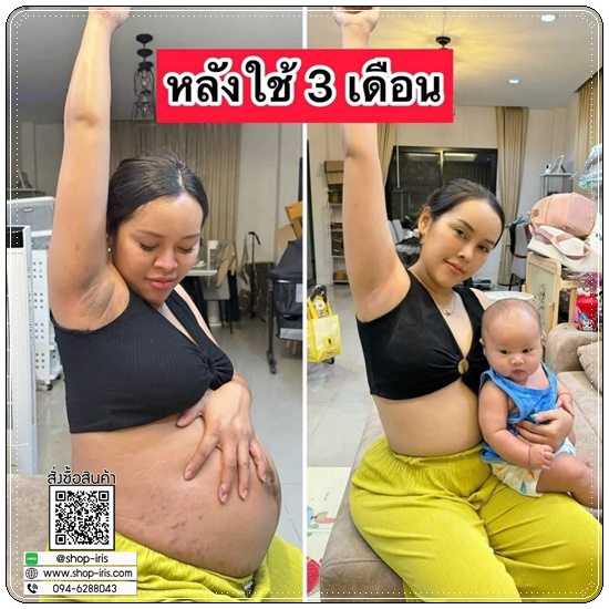 ครีมรักแร้อรอิน ONIN Underarm Care Cream