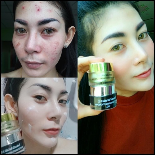 ไนท์ครีม RCC ของแท้ ส่งฟรี