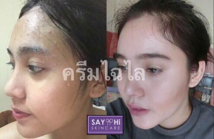 ไฉไลครีม By Say Hi Skincare