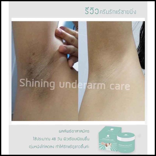 ครีมทารักแร้ชายนิ่ง Shining Underarm Care Cream (ของแท้ ส่งฟรี)