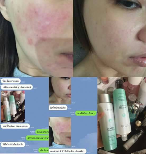 เซน่า มารีน แพลงก์ตอน (Sena Marine Plankton Water Serum Concentrate) น้ำตบแพลงตอน
