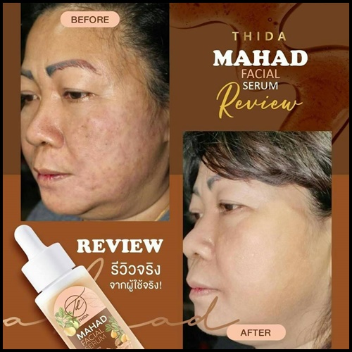เซรั่มมะหาดธิดา Mahad Facial Serum BY Thida