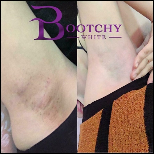 บูทชี่ไวท์ Bootchy White แพ็คเกตใหม่