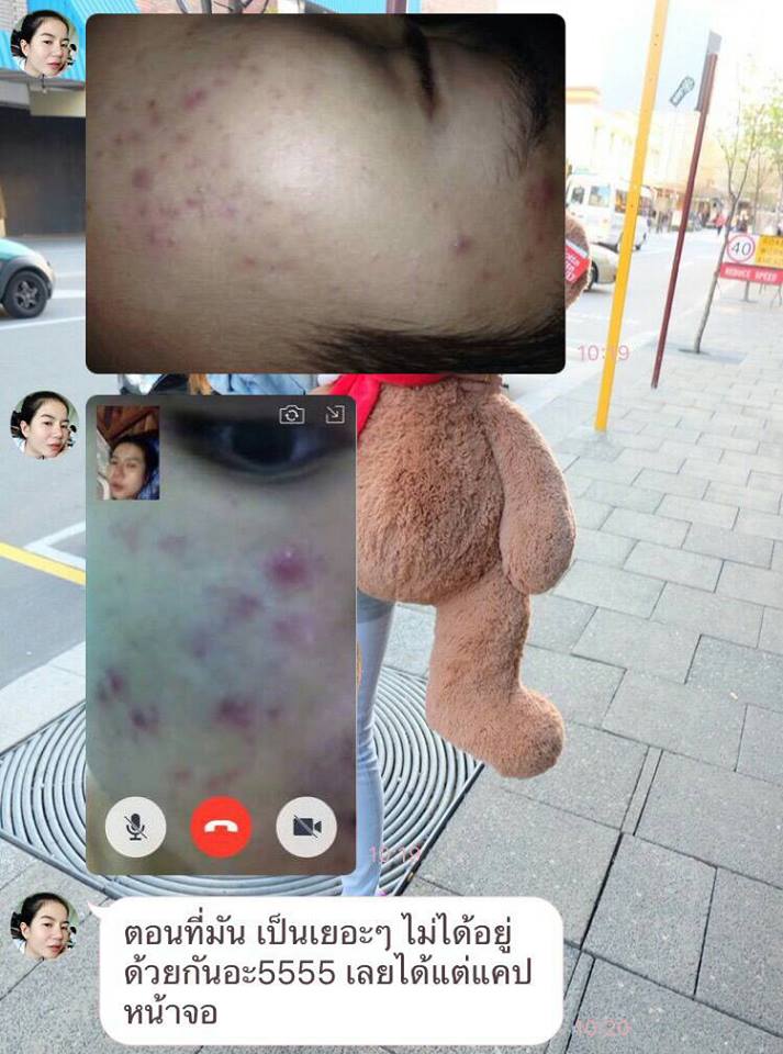 สบู่ Ami Detox Anti Acne เอมิ สบู่ดีท็อกสิวและริ้วรอย