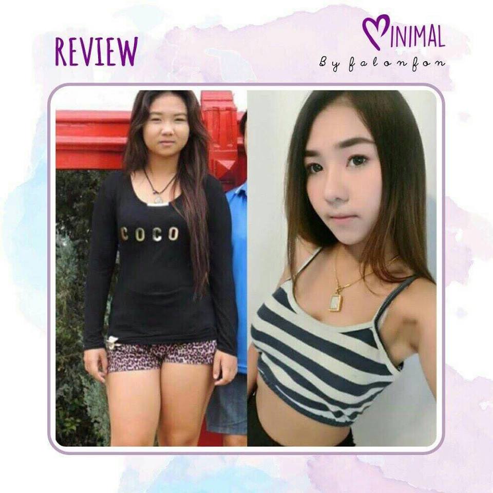 ยาลดน้ำหนัก Minimal By Falonfon ส่งฟรี EMS