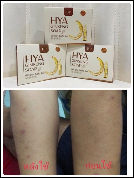 สบู่บีพีโสมไฮยา BP HYA GINSENG SOAP