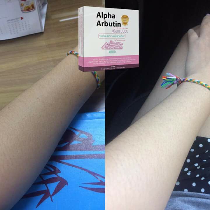 ผงเผือกอาร์บูติน (Alpha Arbutin By KYRA)