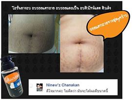 โลชั่นยางลบ by Hiper