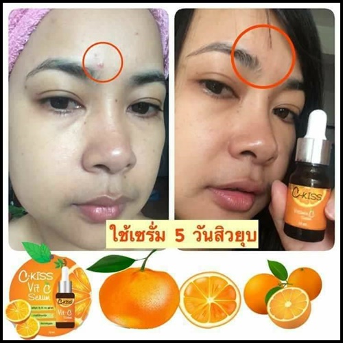 ซีคิส วิตซี เซรั่ม C-Kiss Vit-C Serum