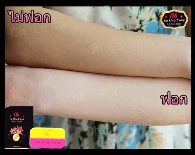 สบู่ระเบิดผิวขาว By โอ้ ละอองฟอง (Oh La Ong Fong Gluta Soap)