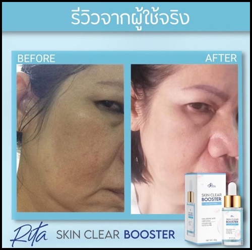 เซรั่มริต้า Rita Skin Clear Booster Serum เคลีย์ สกิน บูสเตอร์
