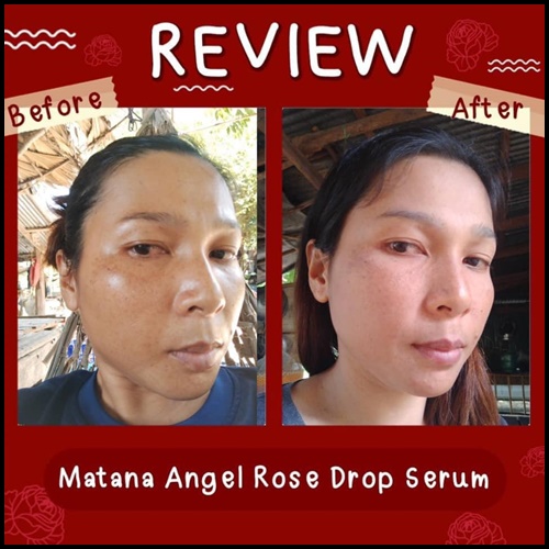 เซรั่มมัทนา Matana Angel Rose Drop Serum เซรั่มหยดกุหลาบนางฟ้า ของแท้ (ส่งฟรี)