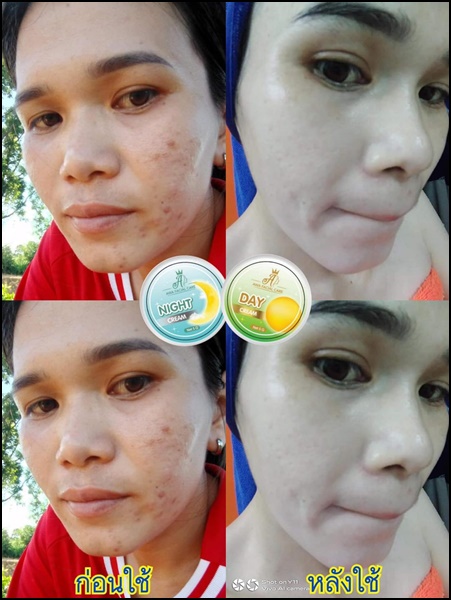 ครีมเอวา AWA Facial Care (ส่งฟรี)