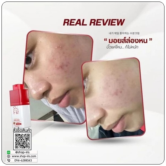 มอยส์ล่องหน SUREFRESH SKIN