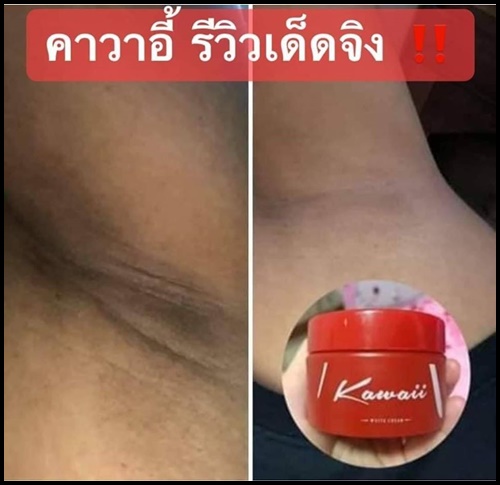 Kawaii ครีมรักแร้ขาว คาวาอี้