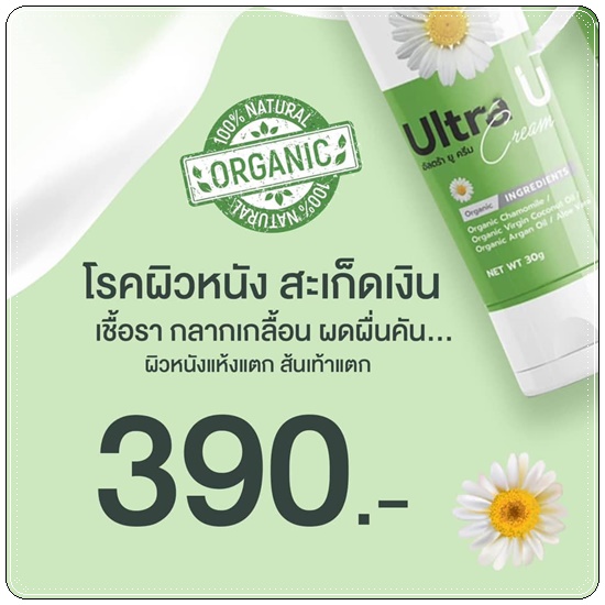 อัลตร้า ยู ครีม Ultra U Cream Natcha ลดอาการคัน กลากเกลื้อน