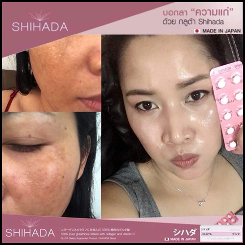 ชิฮาดะ กลูต้า Shihada Gluta