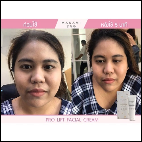 Manami Pro Lift Facial Cream ครีมหน้าเรียว ยกกระชับผิว