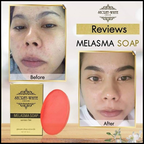 สบู่สลายฝ้า เมลาสมา โซพ MELASMA SOAP by SECRET WHITE CREAM