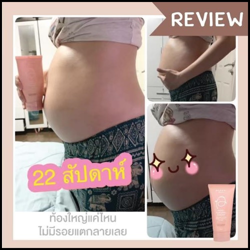 ครีมลดรอยแตกลาย มานามิ (โปรส่งฟรี) Manami Moisturizing Cream Stretch Mark Protection