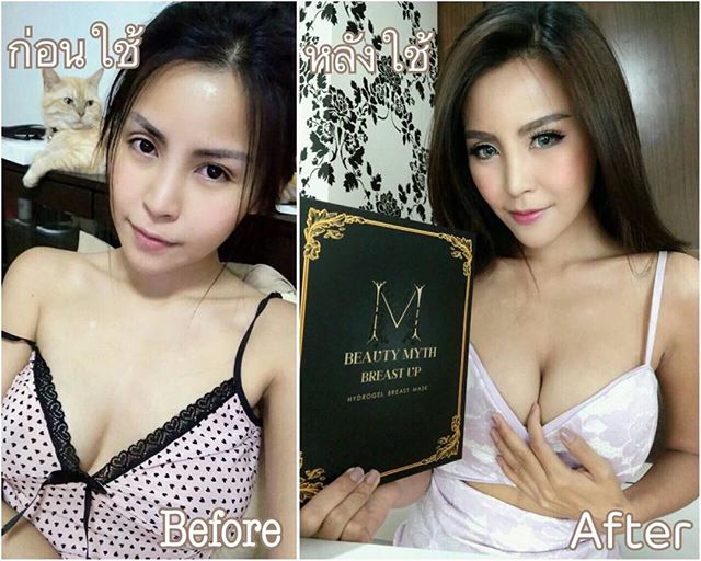 บิวตี้ มิธส์ แผ่นมาส์กบำรุงหน้าอก (Beauty Myth Breast Up Hydrogel Mask) ส่งฟรี EMS