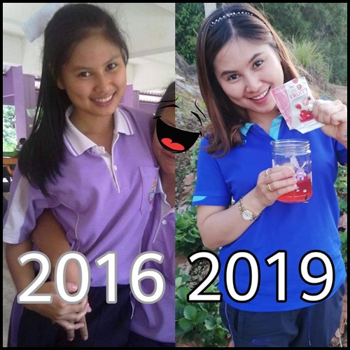 ฟรุตตี้ คอลลาเจน พลัส Fruity Collagen Plus คอลลาเจนบำรุงผิว