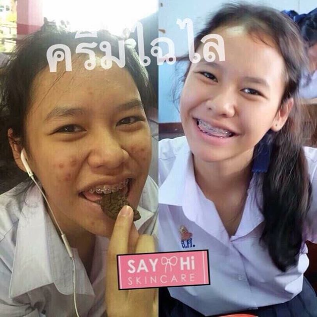 ไฉไลครีม By Say Hi Skincare