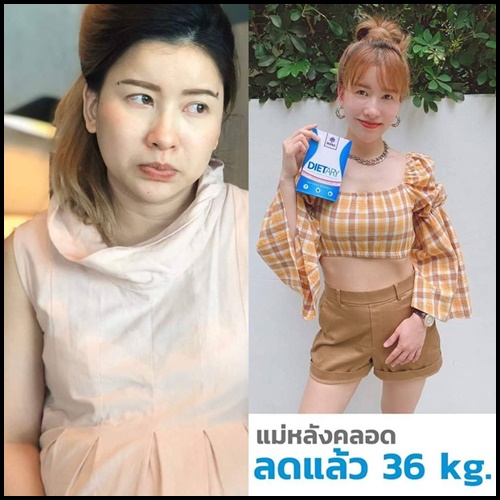 MANA Dietary มานา ไดเอท