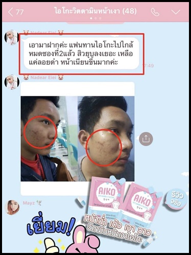 ไอโกะ วิตามินหน้าเงาเกาหลี Aiko Vitamin Facial