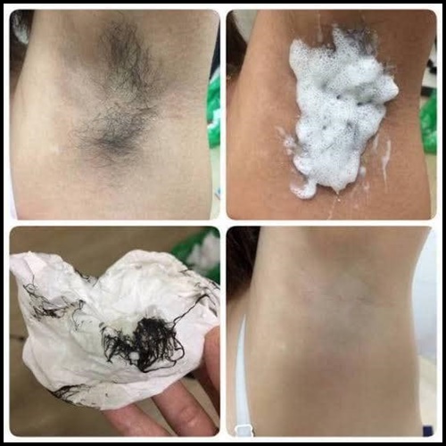 วานีก้า สเปรย์ มูสกำจัดขน Vanekaa Remover Hair Spray
