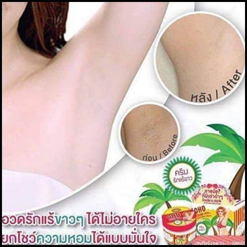 ครีมทารักแร้ขาวโอ้โห OHO Underarm Whitening Cream