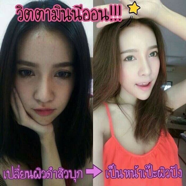 ขาย วิตามินนีออน วิตามินผิวขาว by นีออน ปลีก-ส่ง