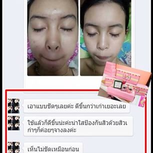 เซ็ตหน้าขาว(amma white set)