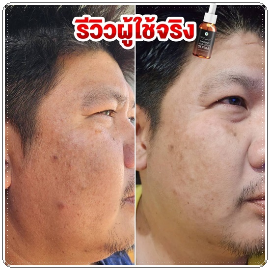 เซรั่มโสมทองไฮยา Ginseng HYA Gold Serum Mermaid