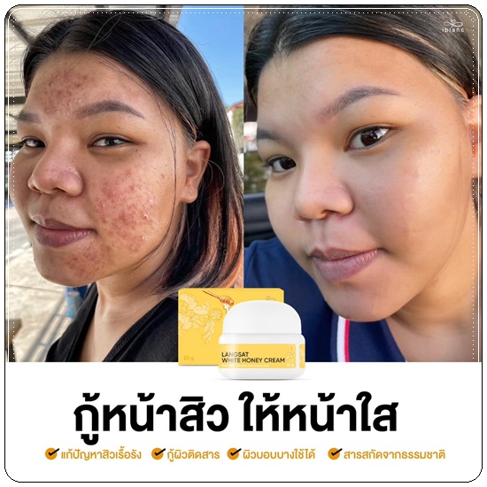 ครีมลางสาด ลดสิว iblanc Langsat White Honey Cream