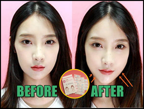 Dodo Label พลาสเตอร์หน้าเรียว