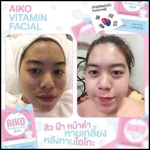 ไอโกะ วิตามินหน้าเงาเกาหลี Aiko Vitamin Facial