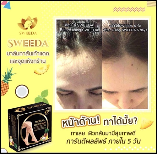 ทรอปปิคอล ฟรุ๊ต บาล์ม บำรุงส้นเท้าแตกและจุดแห้งกร้าน Tropical fruit balm by sweeda