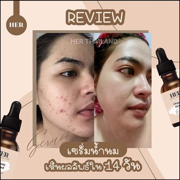 เซรั่มเฮอ HER Organic Herbal Serum