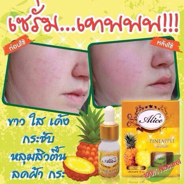 เซรั่มสับปะรด aha100% by Alice