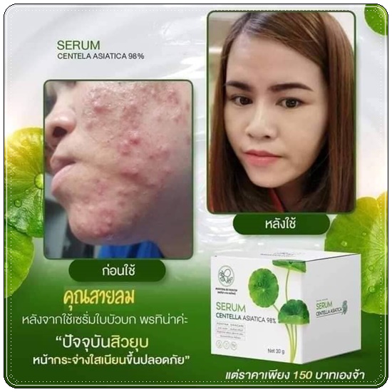 เซรั่มใบบัวบก ผสมว่านหางจระเข้ Serum Centella Asiatica Pontina