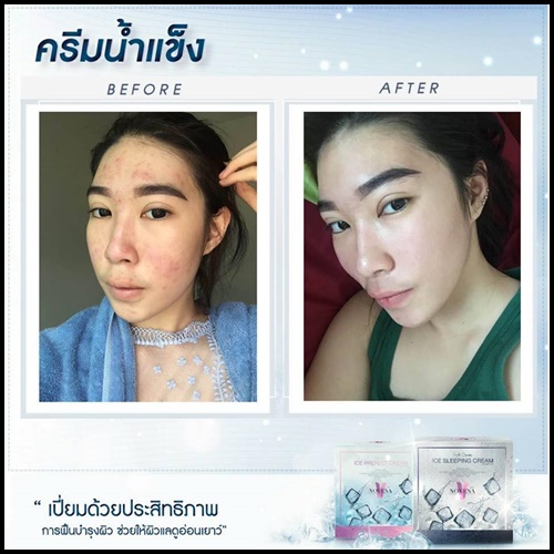 ครีมน้ำแข็ง ไอซ์ เพอร์เฟค ครีม Ice perfect cream By Novena (ครีมกลางวัน)