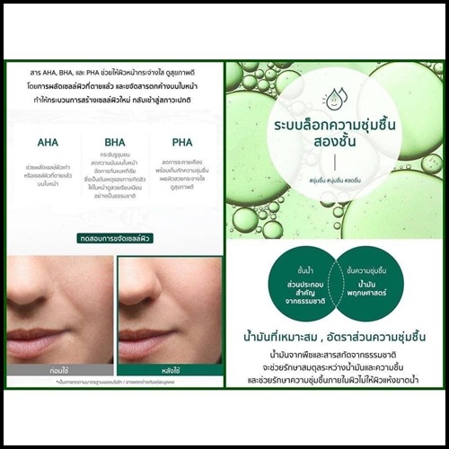 AHA-BHA-PHA 30 Days Miracle Starter Kit ชุดบำรุงผิวหน้า สำหรับผู้ที่มีปัญหาสิวโดยเฉพาะ