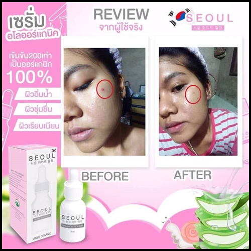 เซรั่มโซล Seoul Organic Aloe Serum เซรั่มอโลออร์แกนิค เข้มข้น