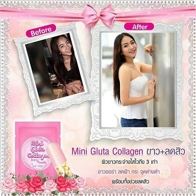 มินิกลูต้าคอลลาเจน Mini Gluta Collagen โปรสุดคุ้ม