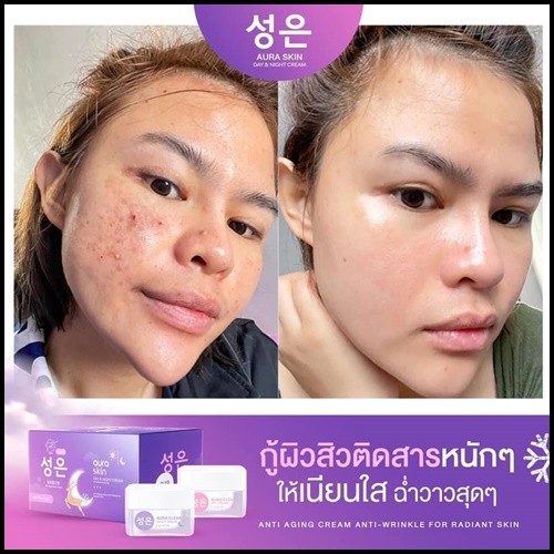 ออร่าสกิน เดย์ & ไนท์ ครีม Aura Skin Day & Night Cream by Thida (ส่งฟรี)