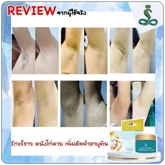 E wan ครีมบำรุงรักแร้ขาว Aura White Underarm Cream