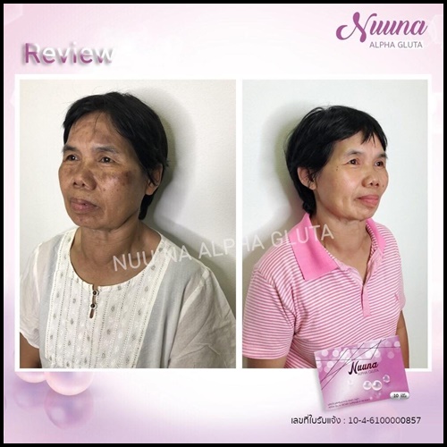 นูน่า อัลฟ่า วิตามินสลายฝ้า Nuuna Alpha Gluta