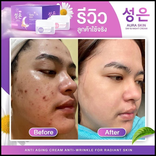 ออร่าสกิน เดย์ & ไนท์ ครีม Aura Skin Day & Night Cream by Thida (ส่งฟรี)