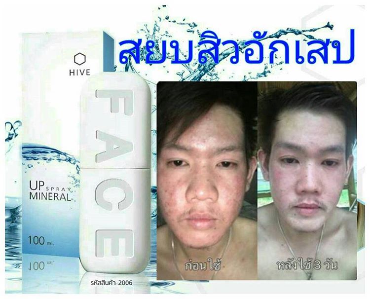 สเปรย์น้ำแร่ ไฮฟ ยู.พี.มิเนอรัล สเปรย์ (LEGACY HIVE UP Mineral Spray จากประเทศแคนาดา)